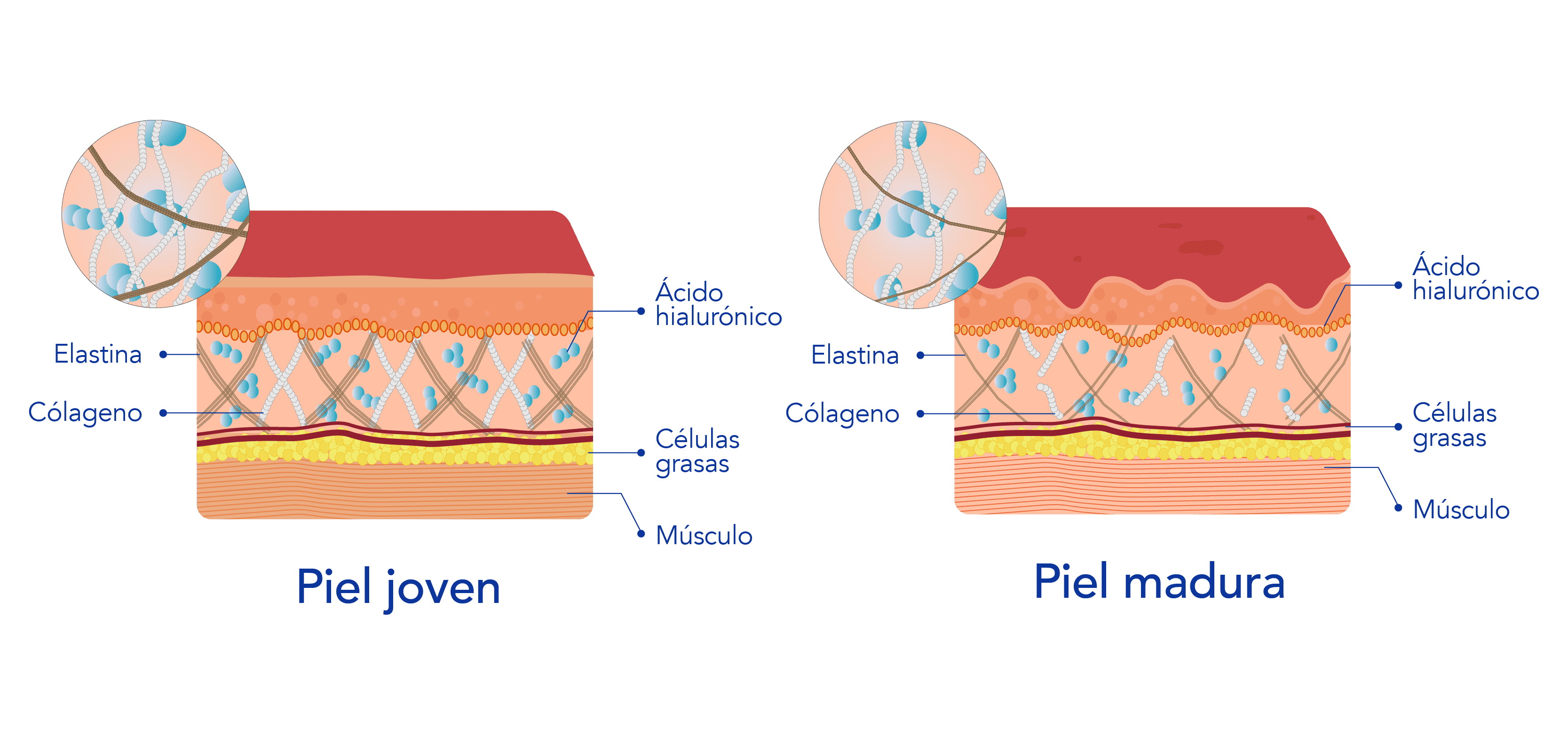 piel-infografias-01