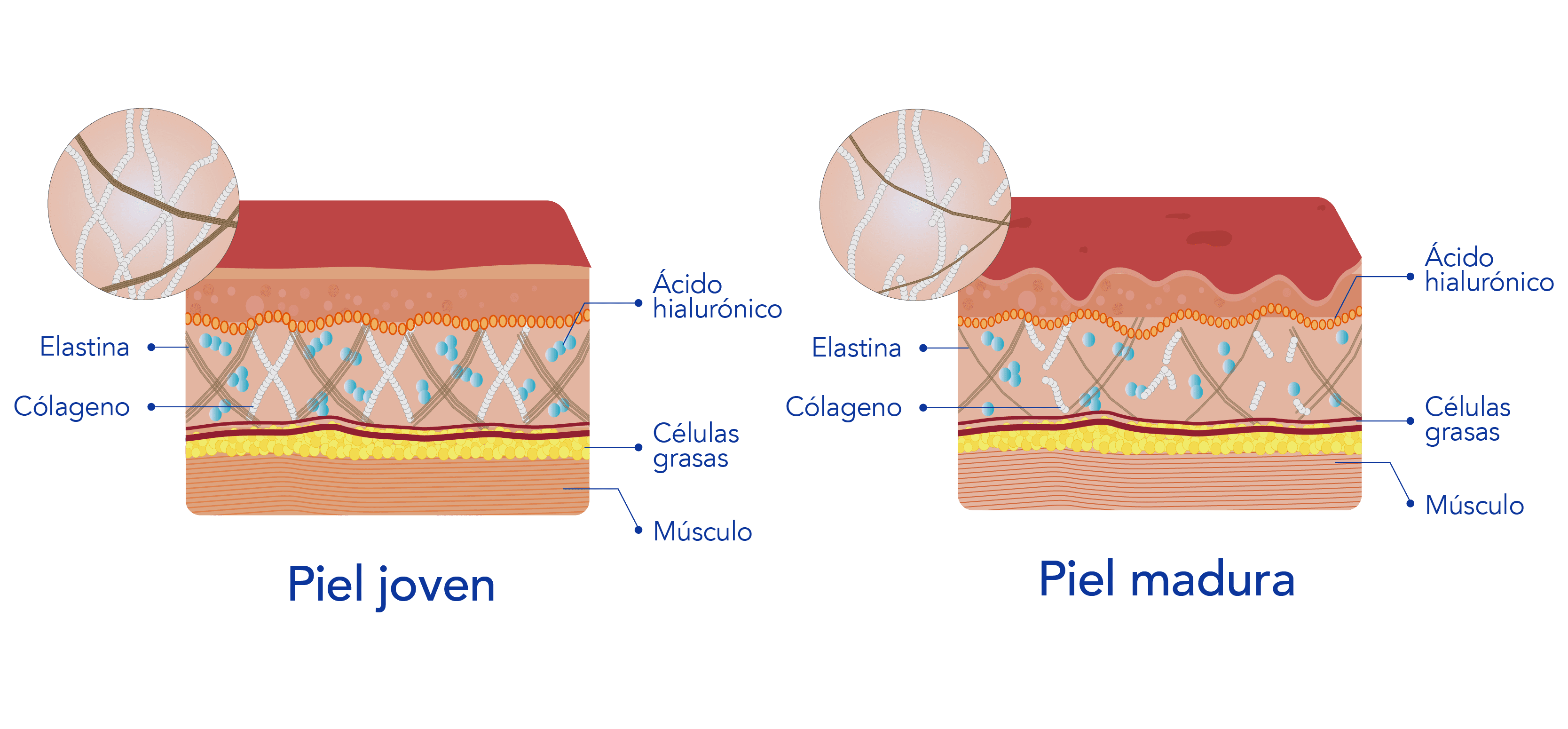 piel-infografias-02